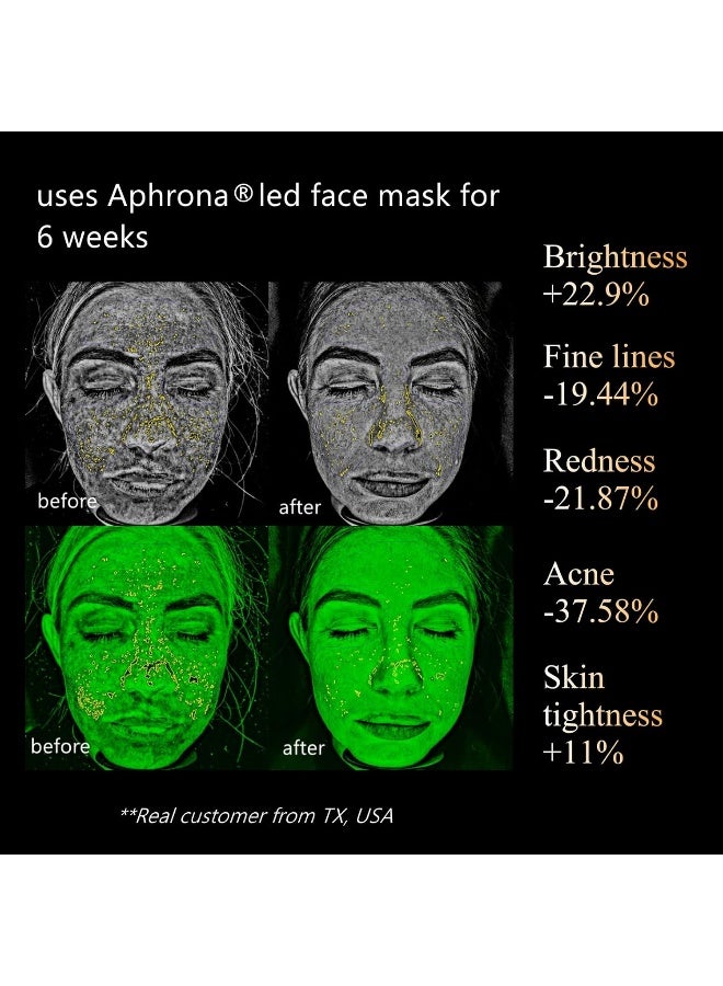 Aphrona Led Face Mask Light Therapy, Halo Led Light Therapy Facial And Neck Skin Care Mask, Blue Light Red Light For Acne Wrinkle Reduce, New Generation Face And Neck Photon Mask - Image 3